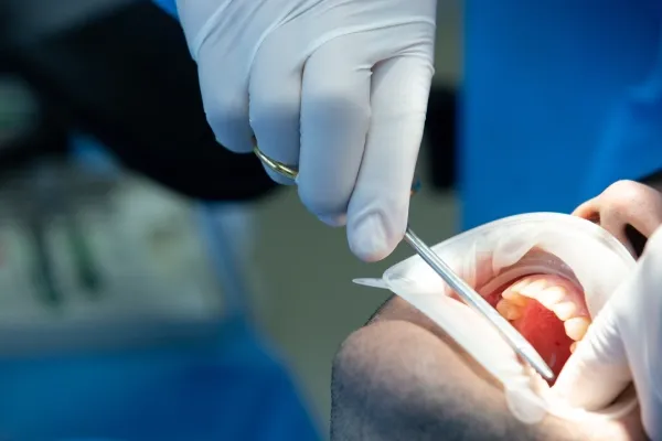 Oral Surgery treatment
