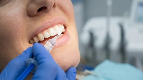 Teeth Whitening treatment