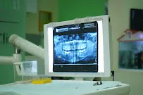 Digital Panoramic OPG Xray Monitor